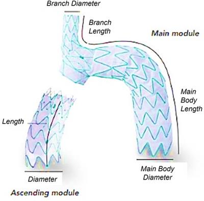 Aortic haemodynamics and wall stress analysis following arch aneurysm repair using a single-branched endograft